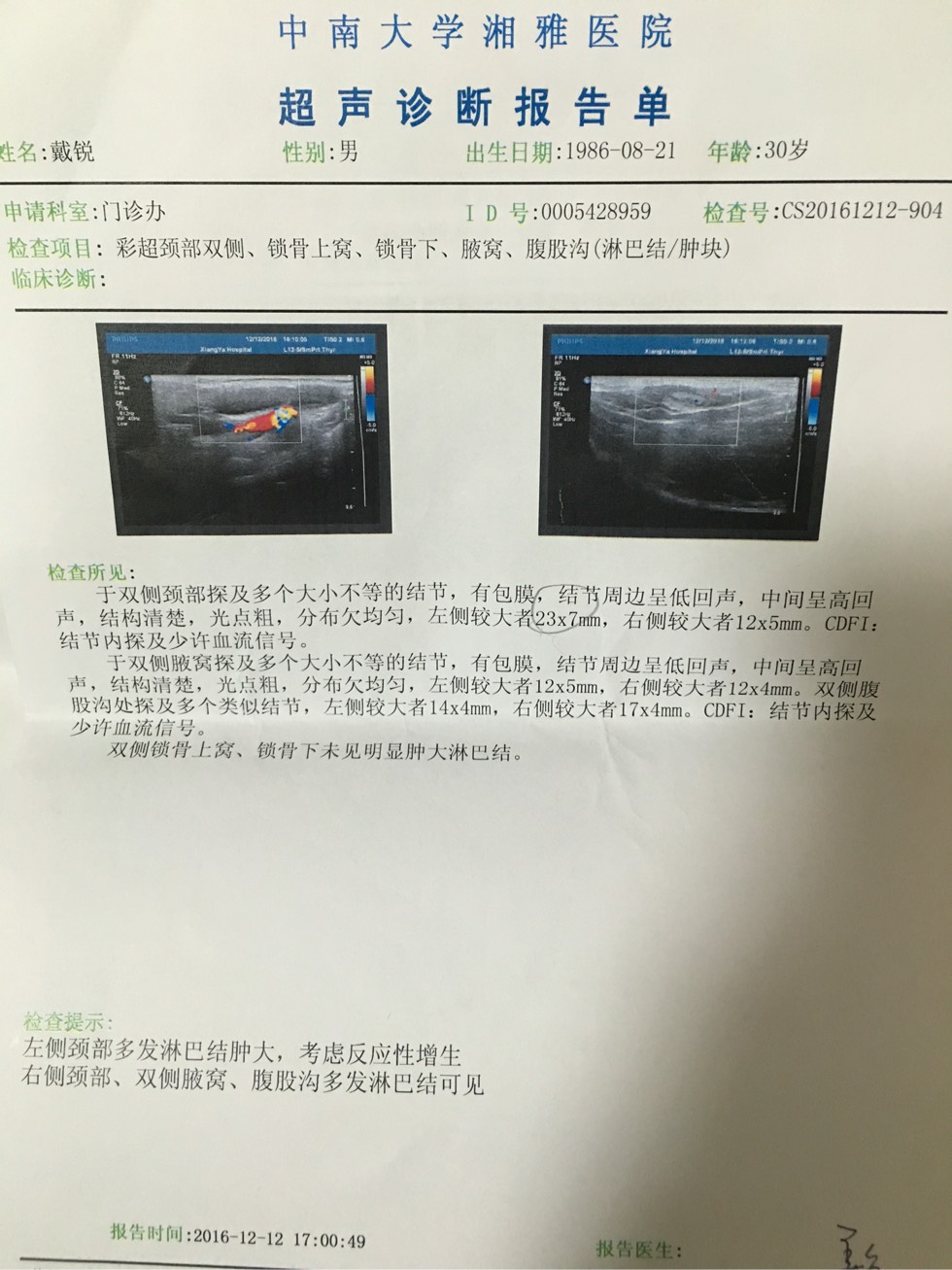 214825fj58dccmuiii544l.jpg