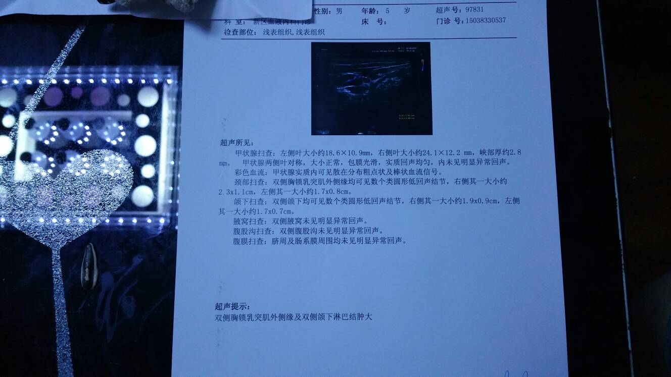 220144fdzxxhixz44a4eaa.jpg