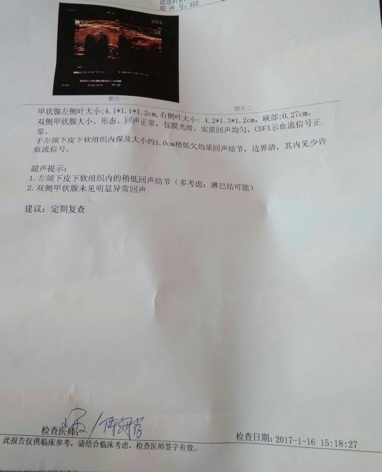 084129pvyf8remxu0vnogz.jpg