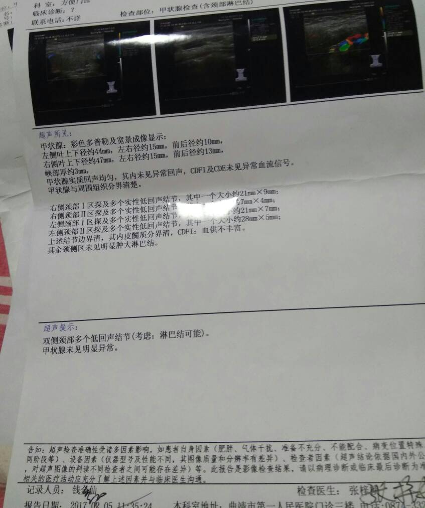 084132fpf385p6tu5562zh.jpg