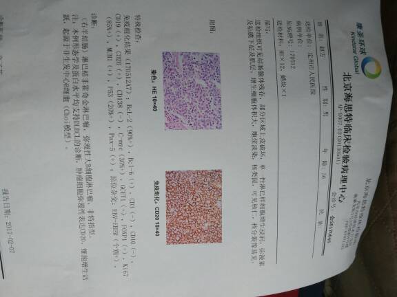 100802zgwdkmbww5wrm1rm.jpg