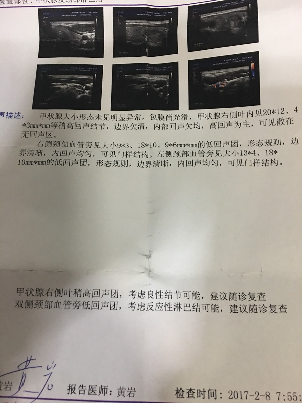 190650f5i48qcu72miy7iu.jpg