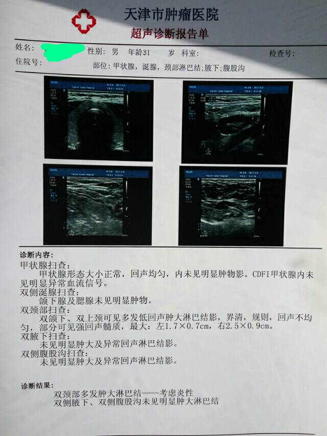 095139yxuoonpn2xs1prmv.jpg