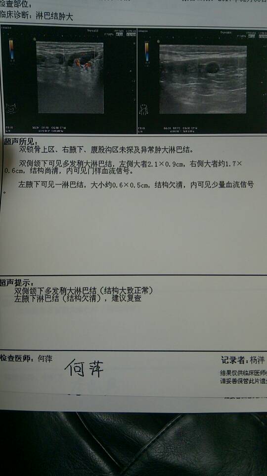 095050lyaer7x2xx87krir.jpg