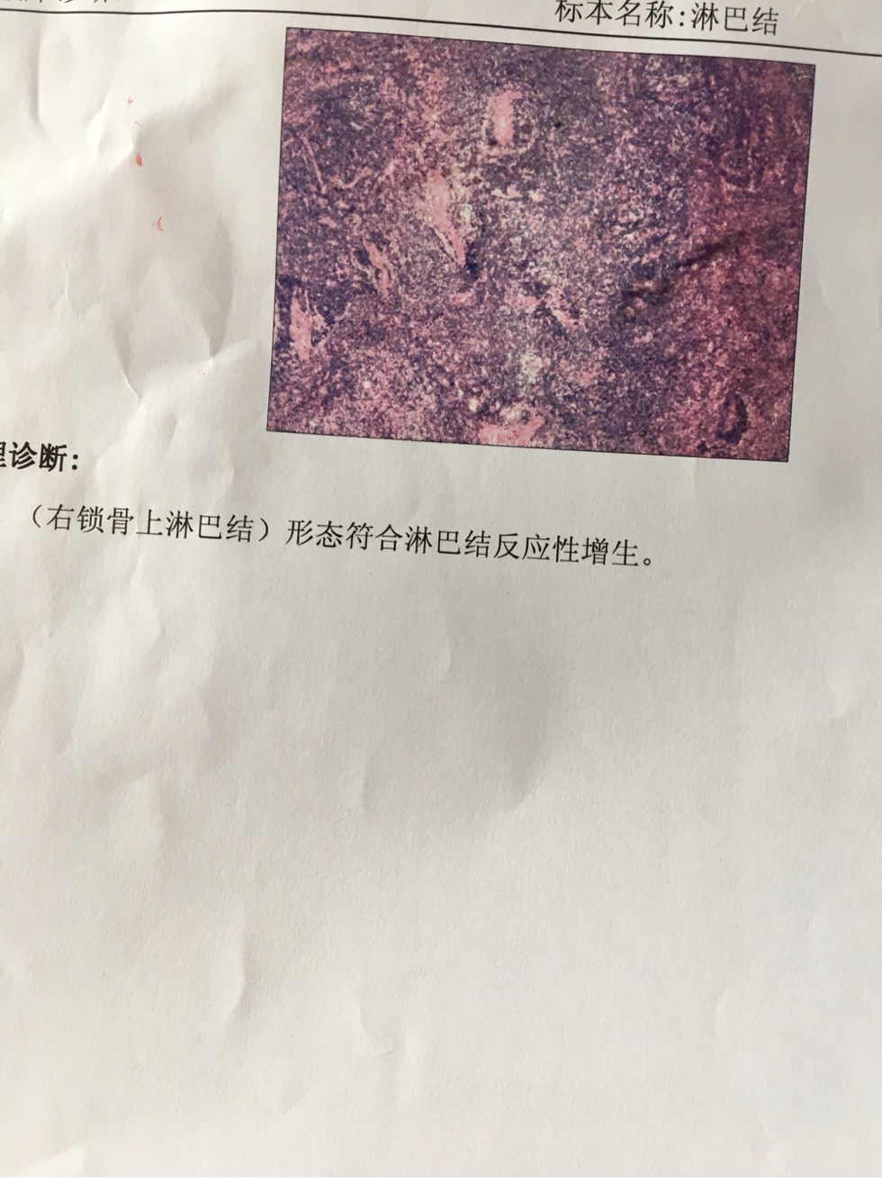 101335drywlp5p9krnq5ml.jpg