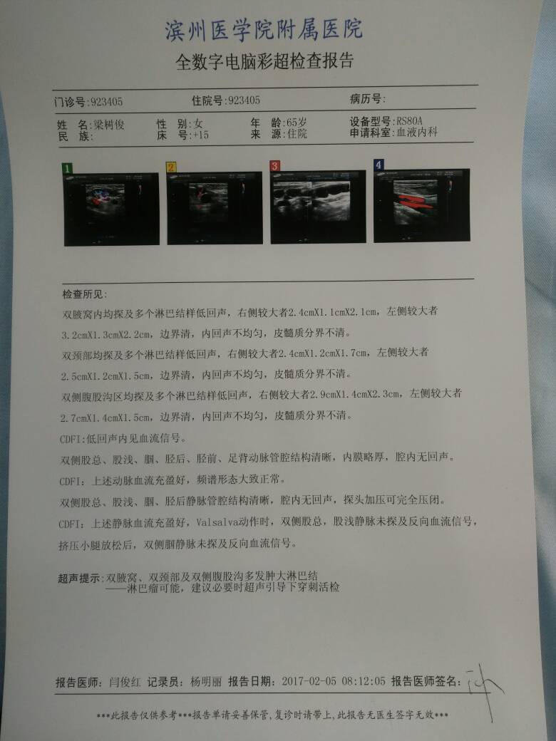 141017gnm88nqhmfy4qhun.jpg