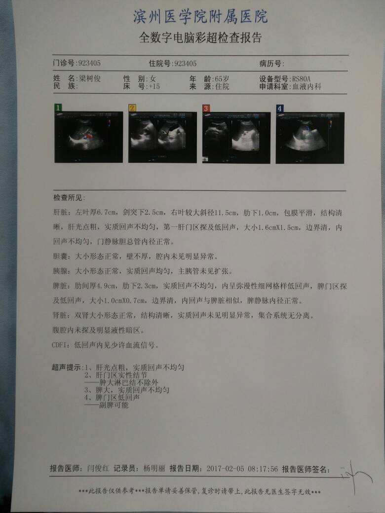 141018pa43ckv4n94z3k4n.jpg