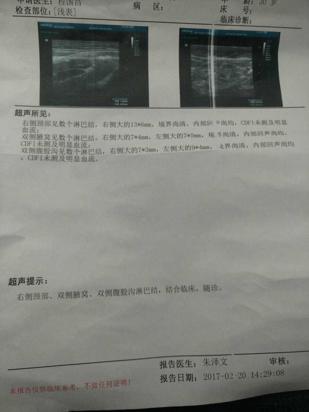 152449z9c2b9771ub7uacb.jpg