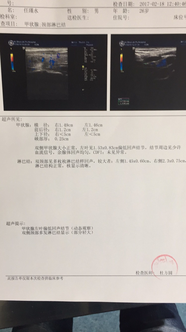 131740zdot4ekam6j0jodt.jpg