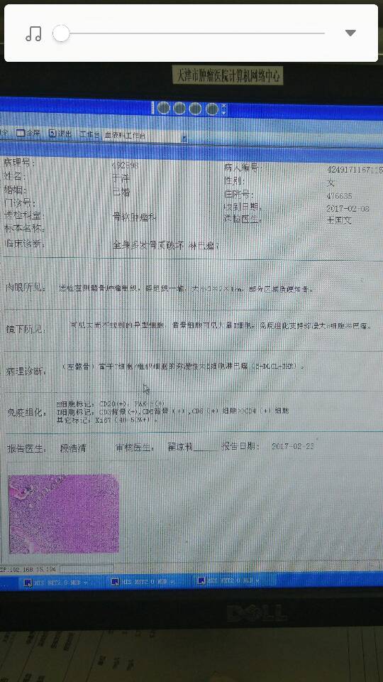 123250ldbcprjxcrb3pd77.png