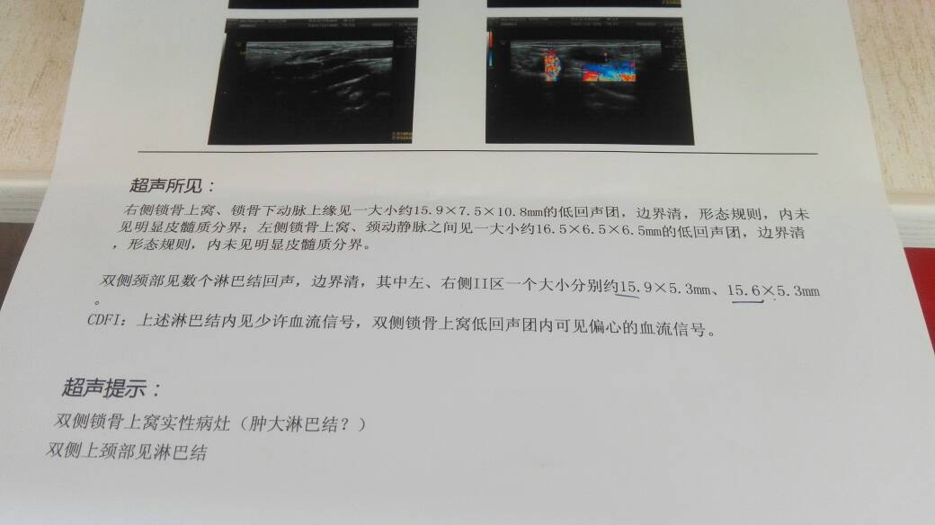 090510h5bb4u1cr144e474.jpg