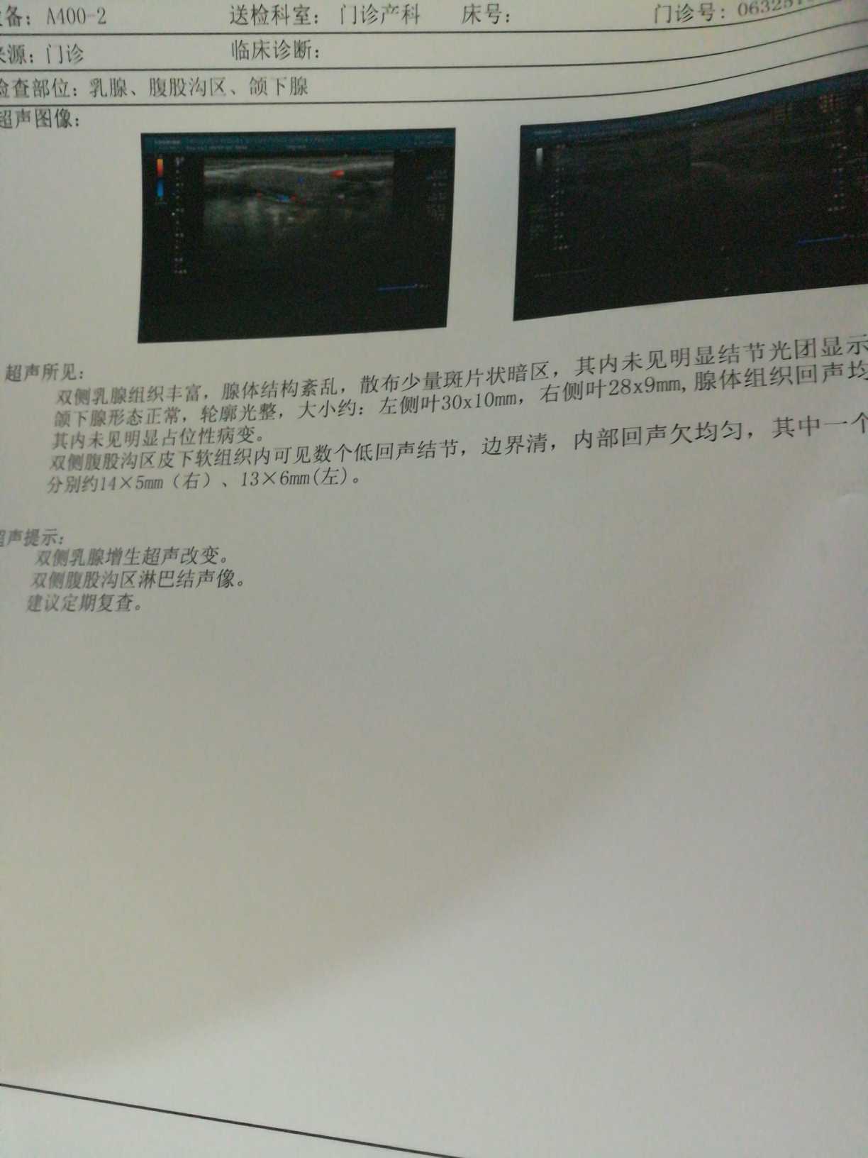222759h61xo8hw2humruub.jpg