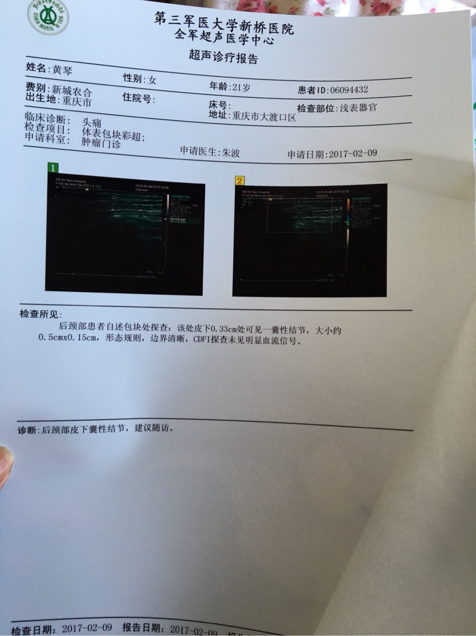 110552m8brb65fpebzrb3p.jpg