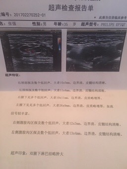 162039awinu1ujnzsu28kd.jpg