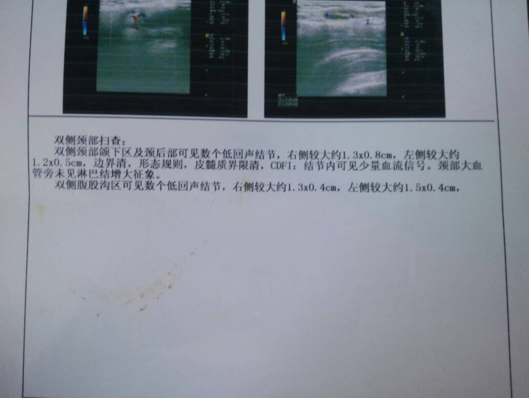 085406ewpqymam9zq0rbcj.jpg