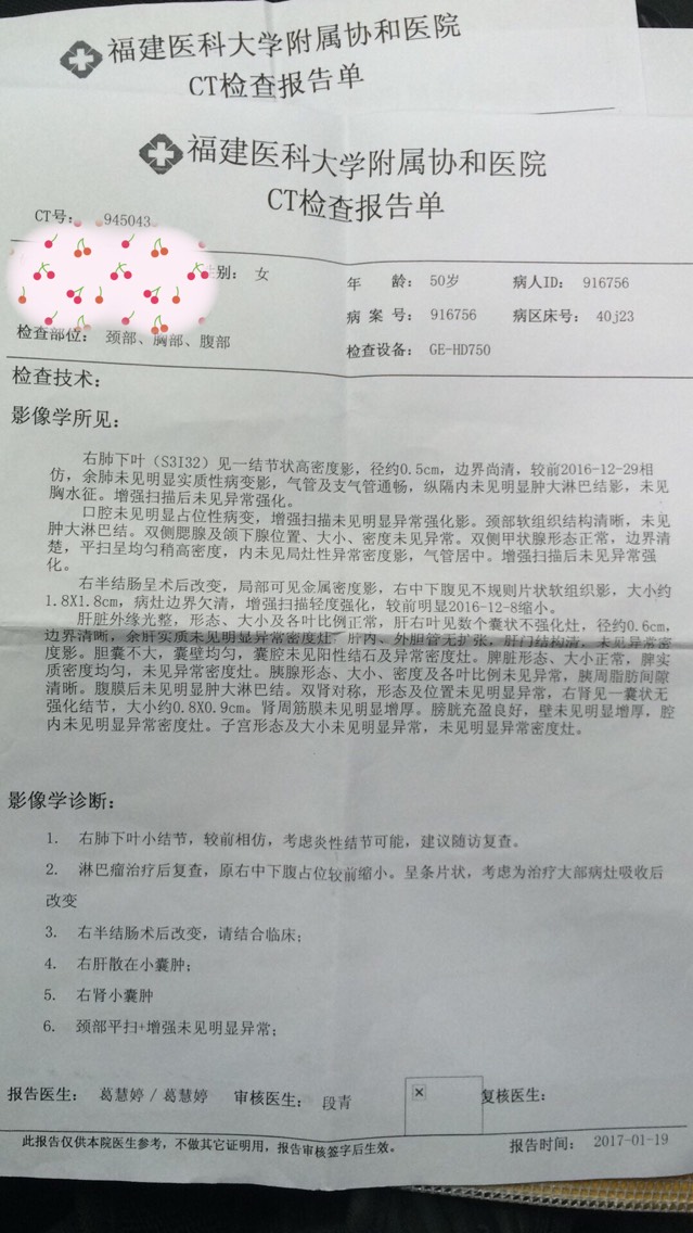 160404f94ni18fiiini0xi.jpg