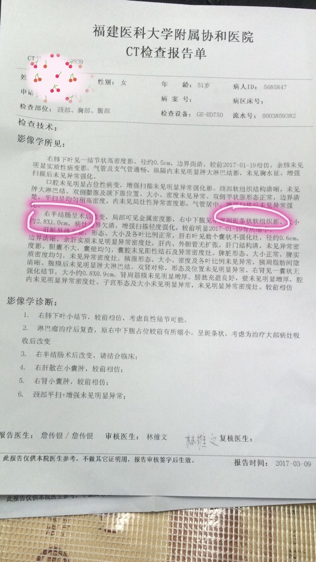 182525qxwk7zppmpwk66xu.jpg