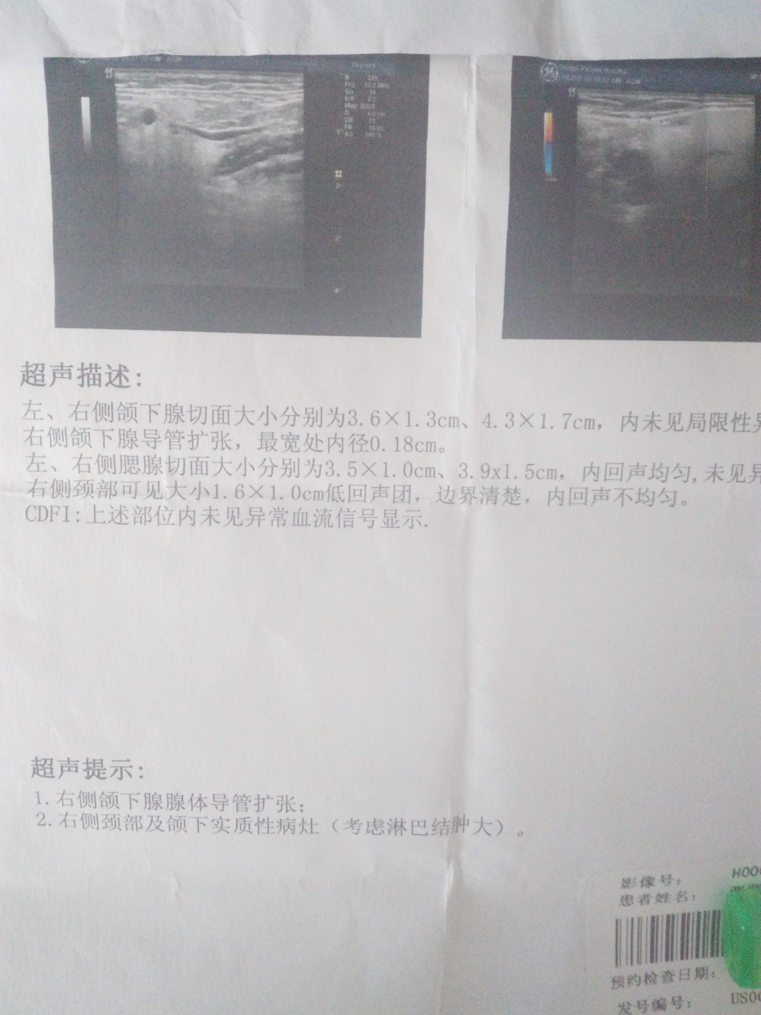 164917j9up0wbrb8rwpur9.jpg
