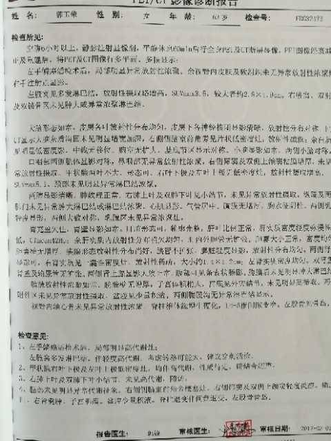 170508yppmjrtl7ryl61cw.jpg