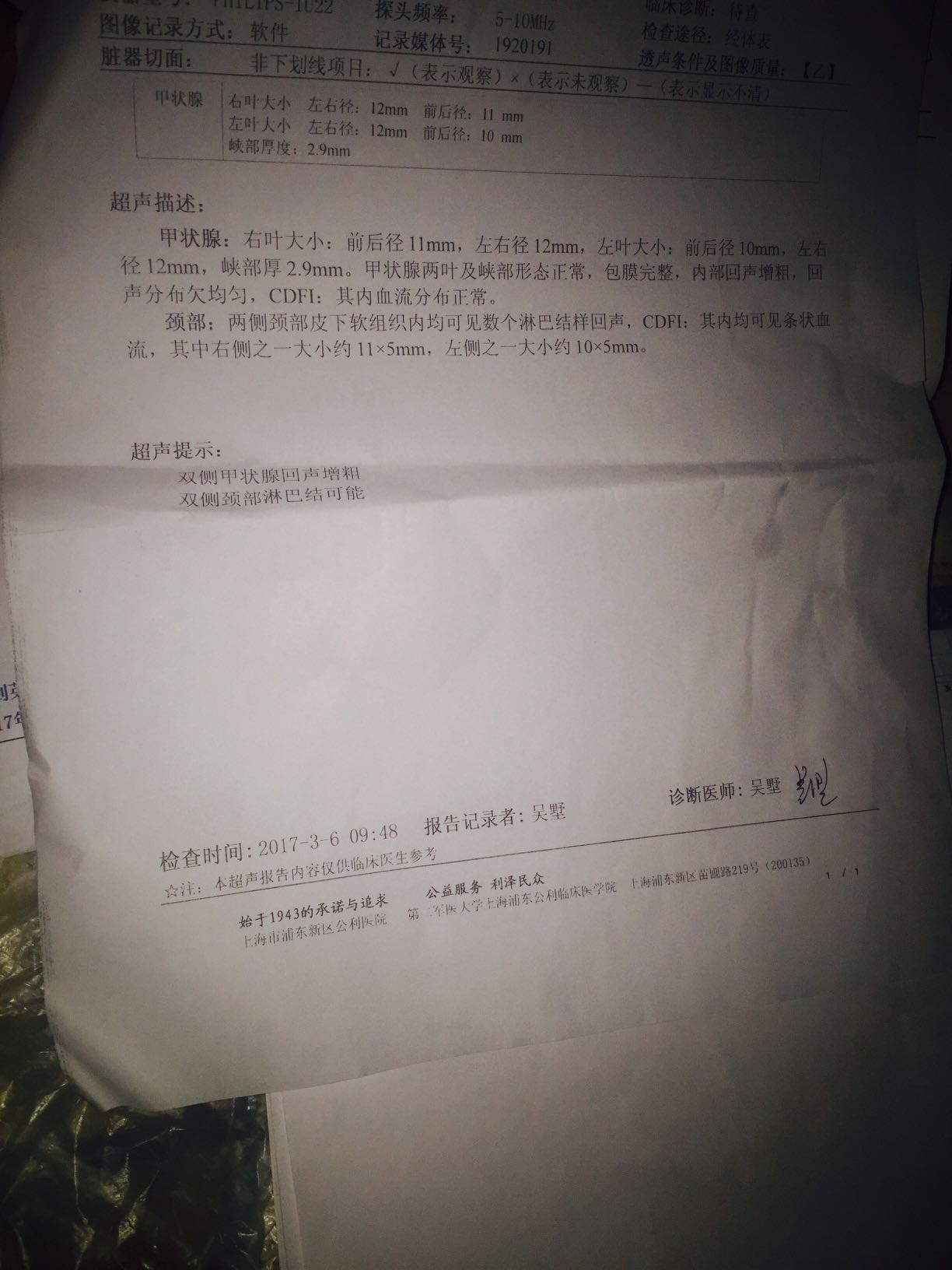 070900m224f4fa7iyup8ef.jpg