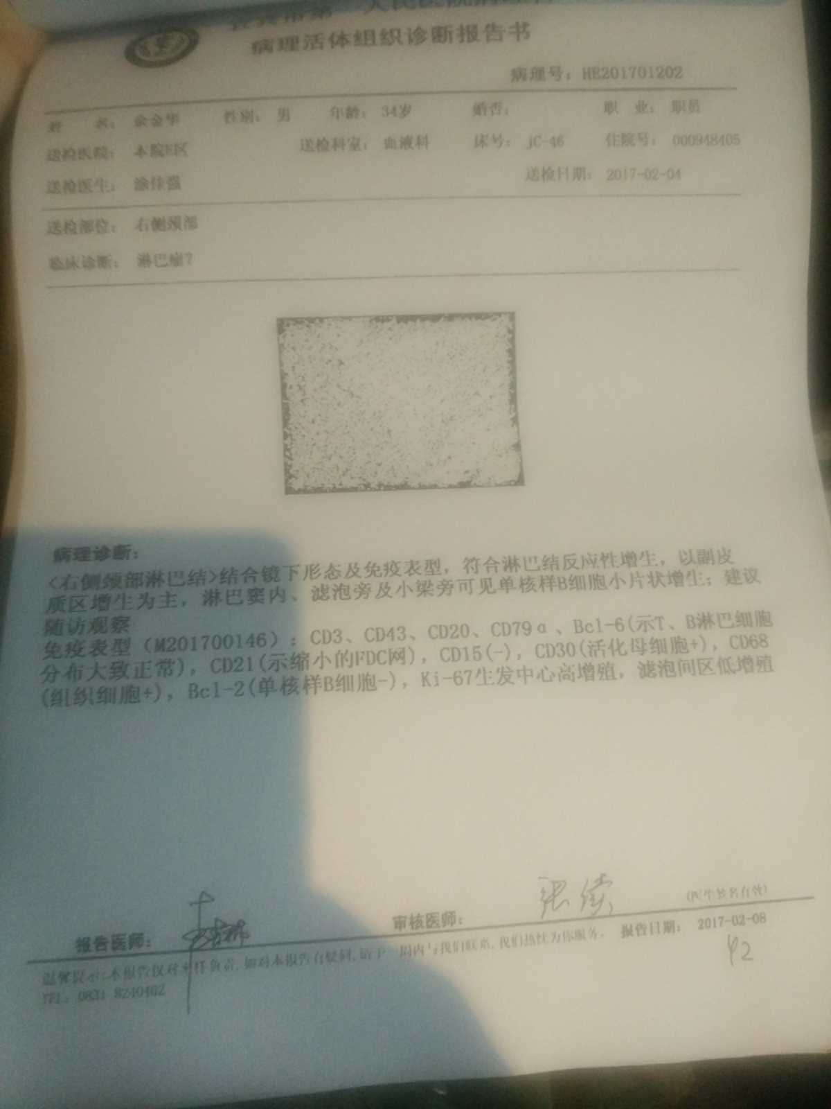 161352s4ua7uv1g147gg46.jpg