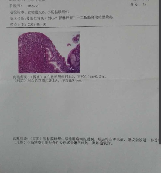 微信截图_20170317130015.png