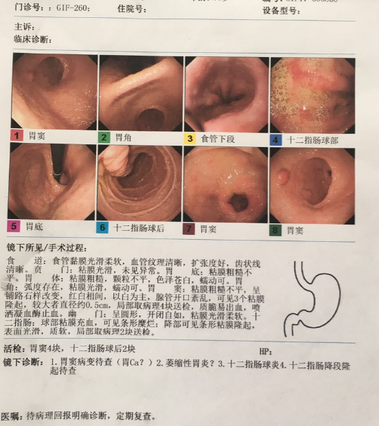微信截图_20170317125942.png