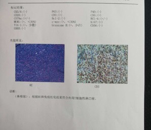 094150tl9pjlll32m1fm10.jpg