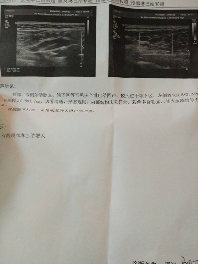 094532gx1zpkltvev5lrrk.jpg