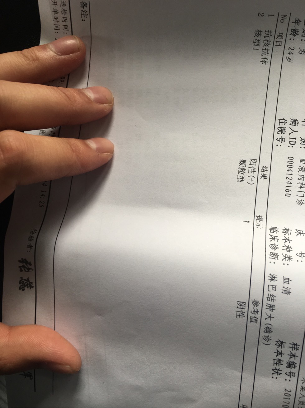 风湿抗核抗体 阳性