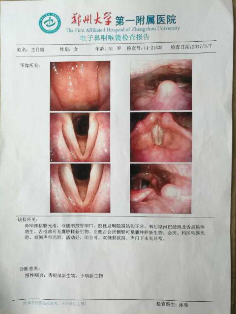 215152wffj9m2uz933299j.jpg