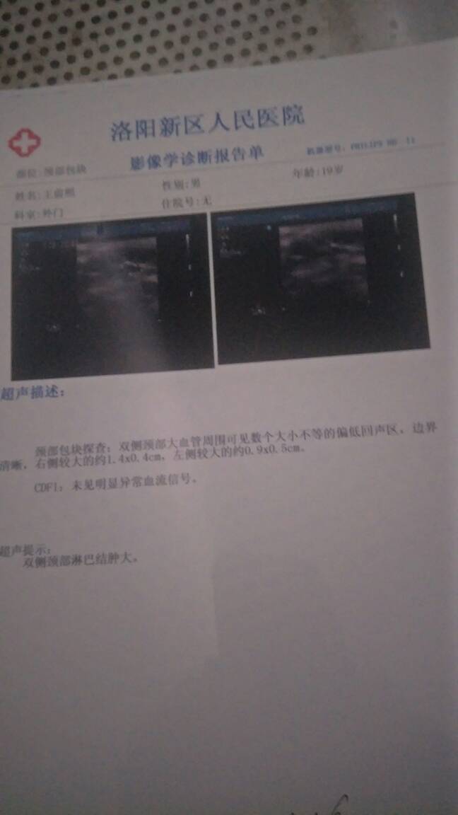 135414lculx4ksz88u87z1.jpg