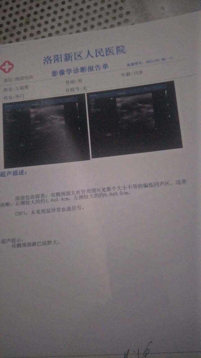 135415euo9r6yoru6tv0vt.jpg