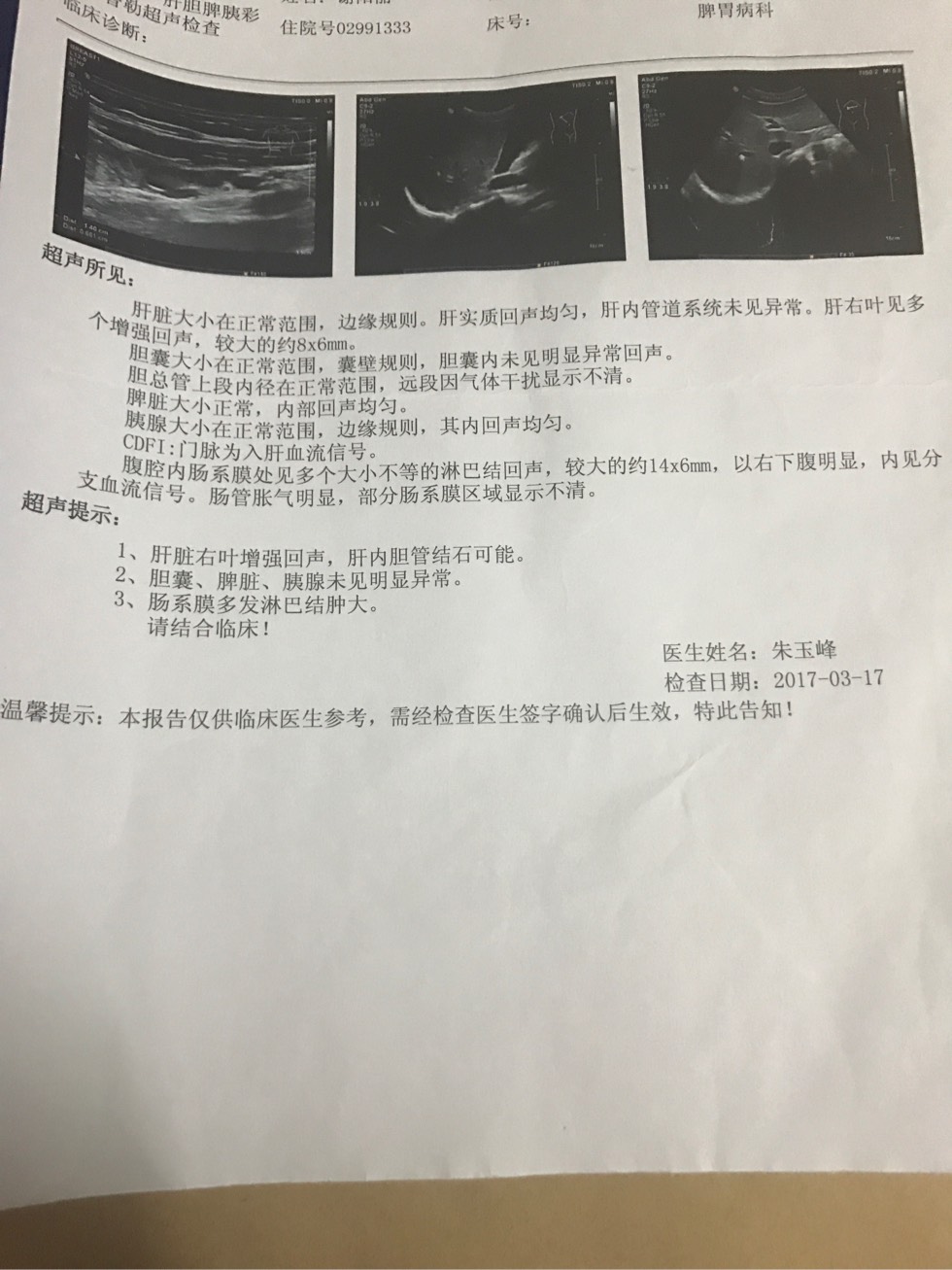 170645xk1akukq418461qk.jpg