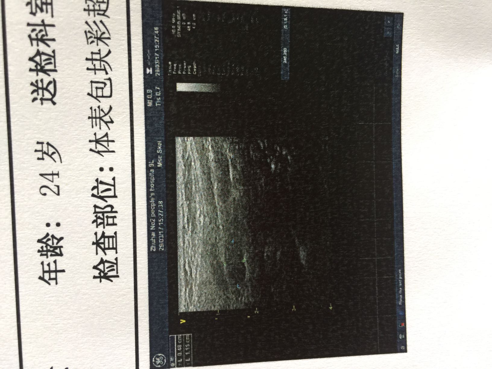 172427rx7sdz4cex4ojzx0.JPG