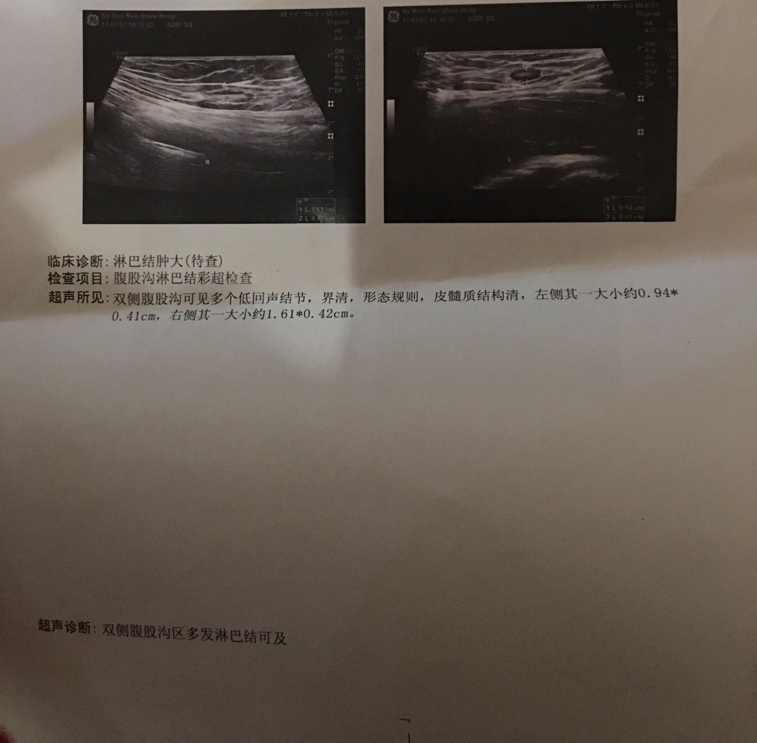 192315yohyy2xhb9yw91n1.JPG