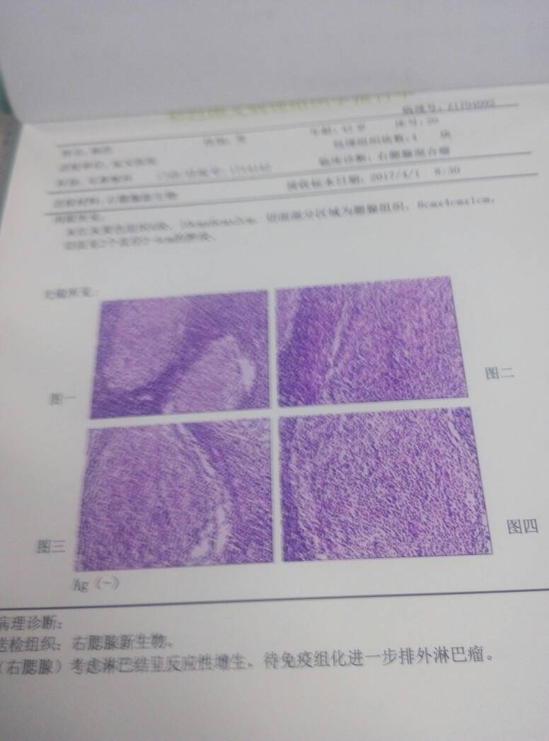 175021joudozu0c8mud8q0.jpg
