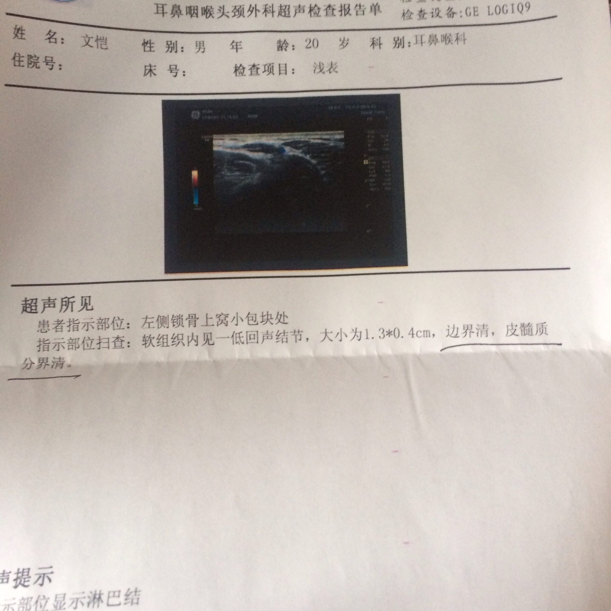 092102kdiux791uv6t9i47.jpg