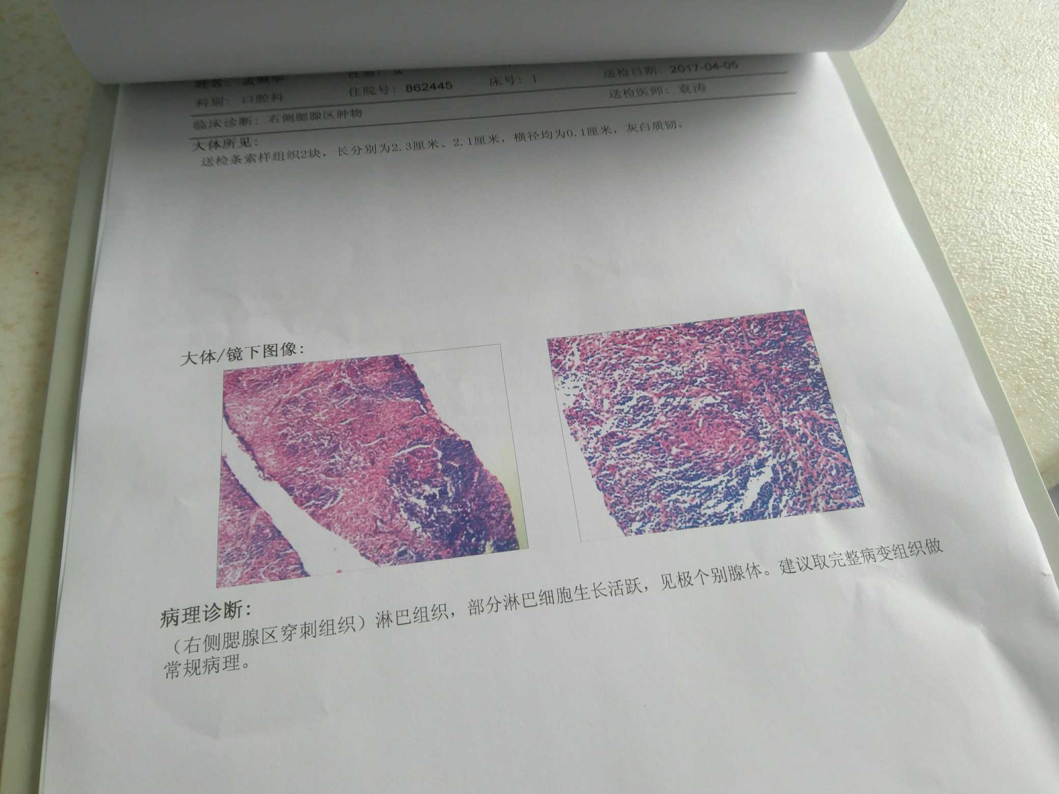 175007n6ie9sfqhh6is2ty.jpg