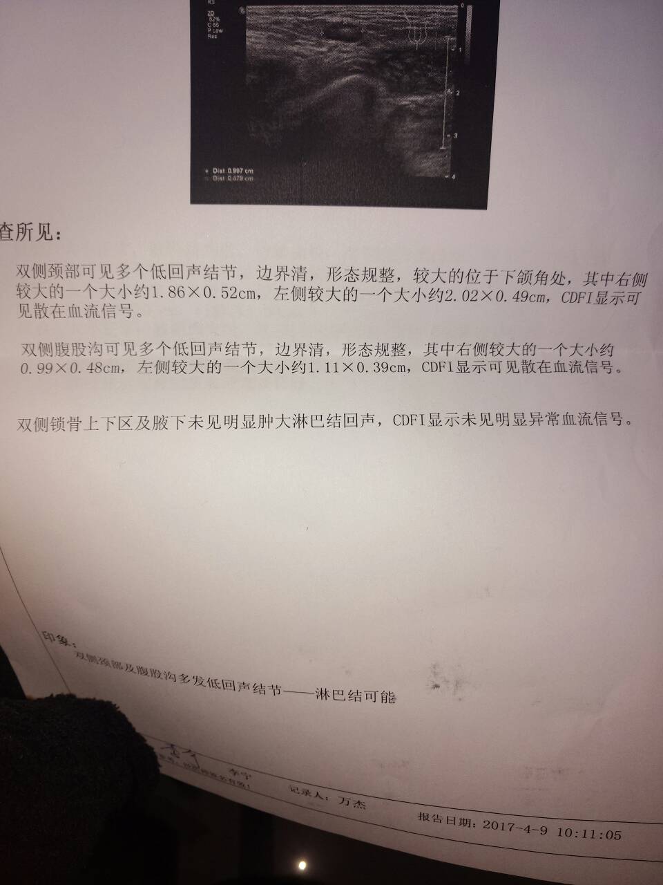 171401hbxwekgm33qzkx2g.jpg