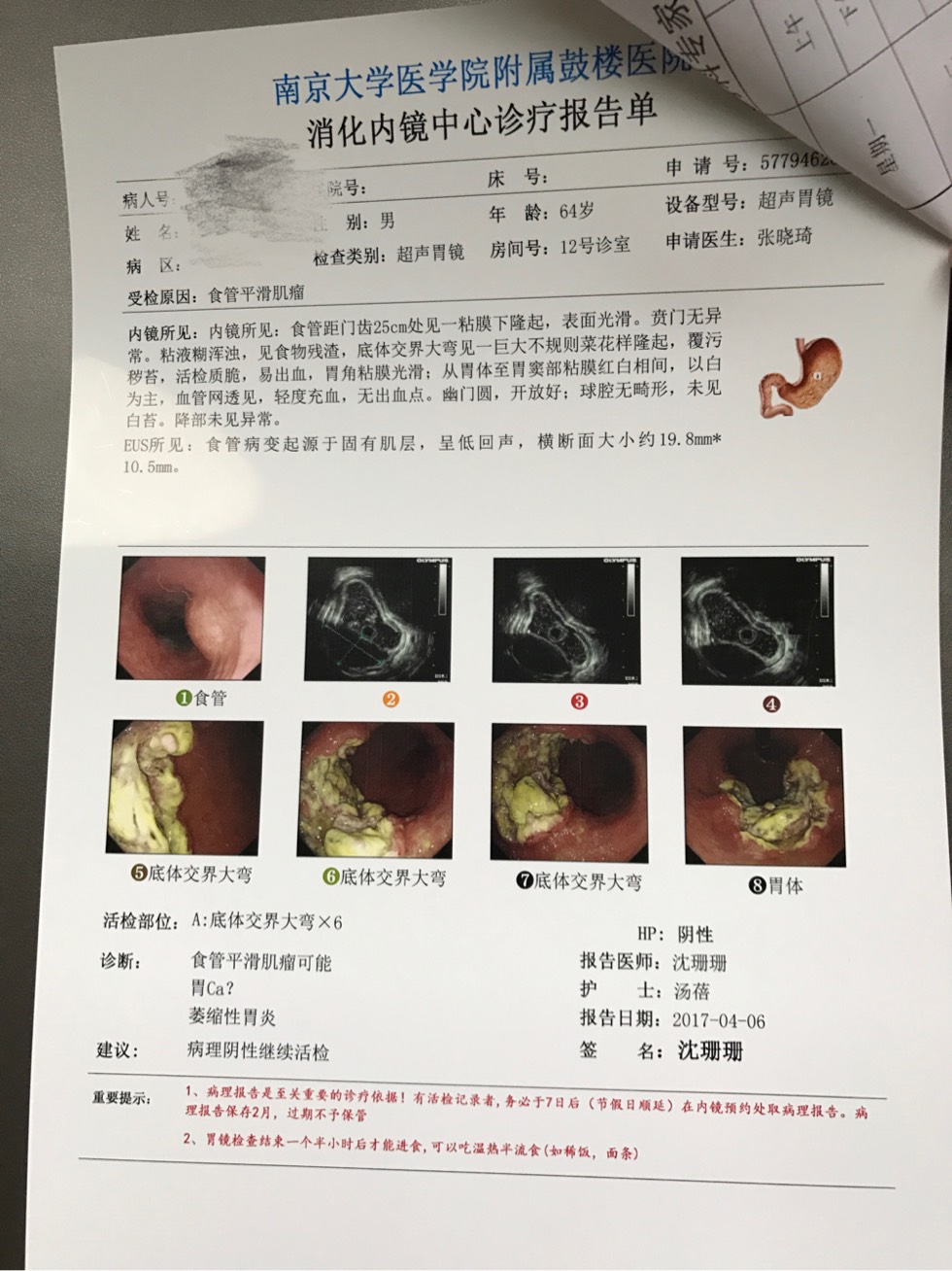 161219jmuqxv268zbxx6xx.jpg