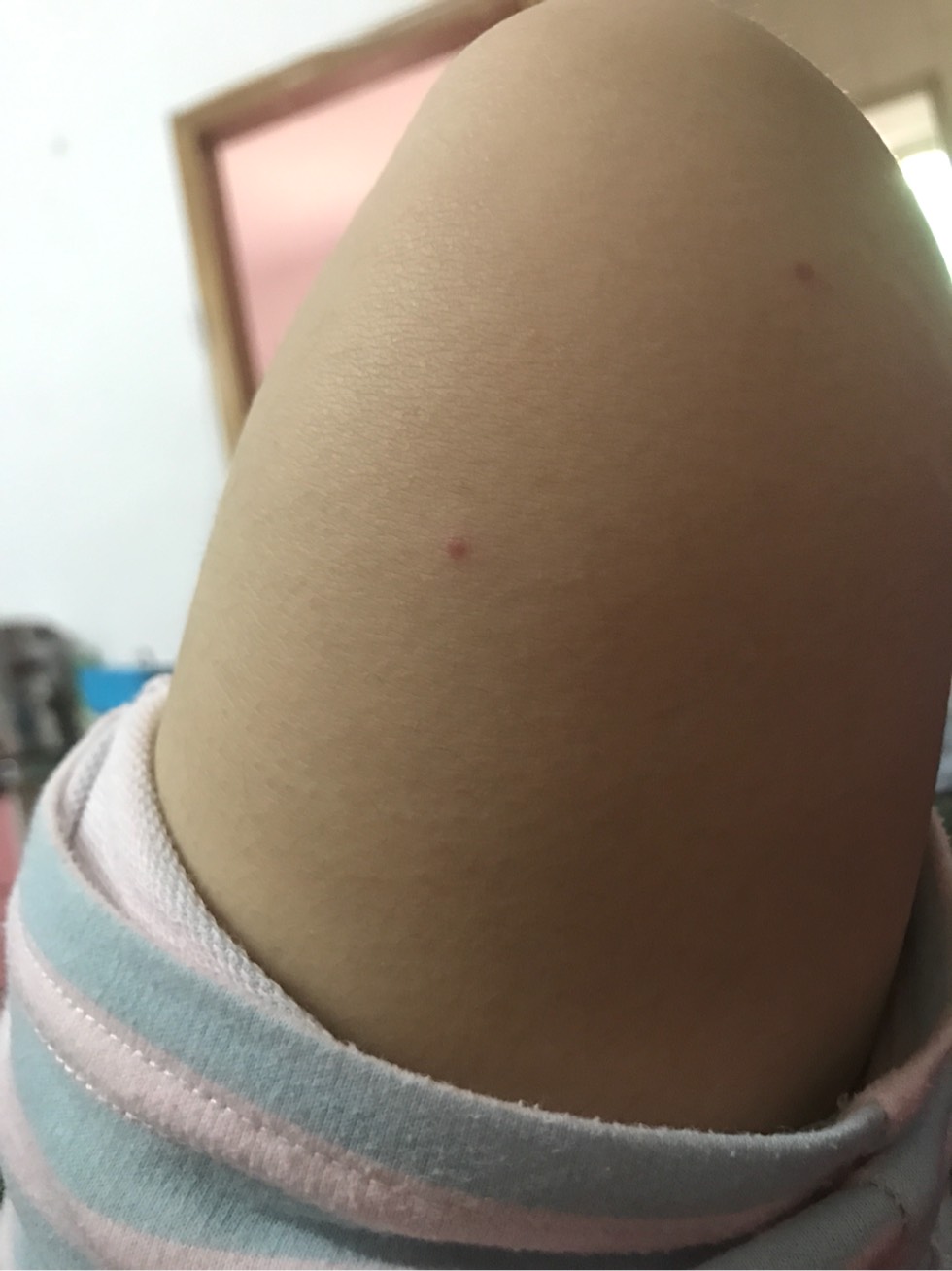 085607ryjx2cs820izxqc0.jpg