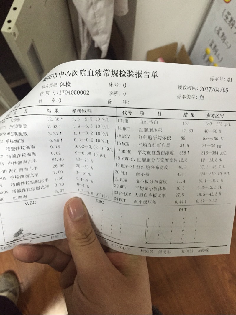 084521gbbrcy81d618bmrm.jpg