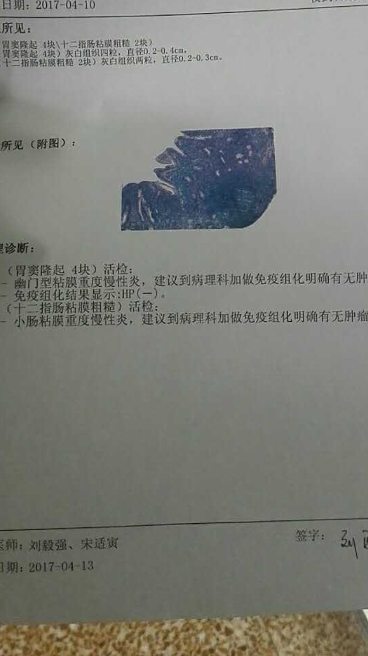 141124yppotl3jit66thpn.jpg