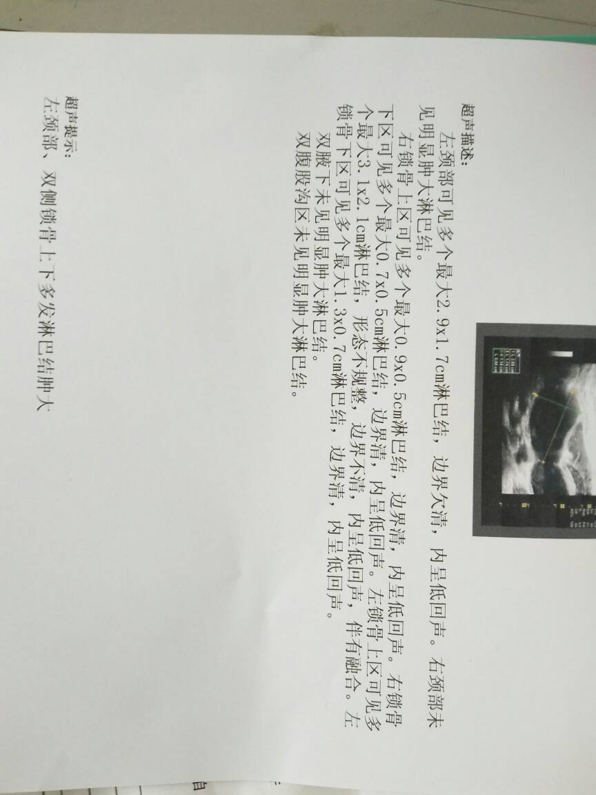 163210mbjr7ft8cjrvcs88.jpg