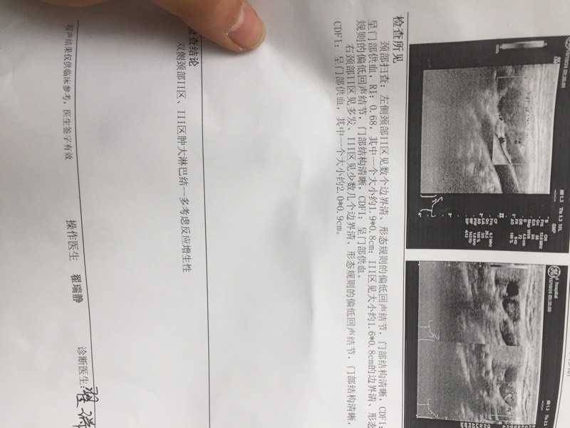 170654voy9lvvnrkun0mrv.jpg