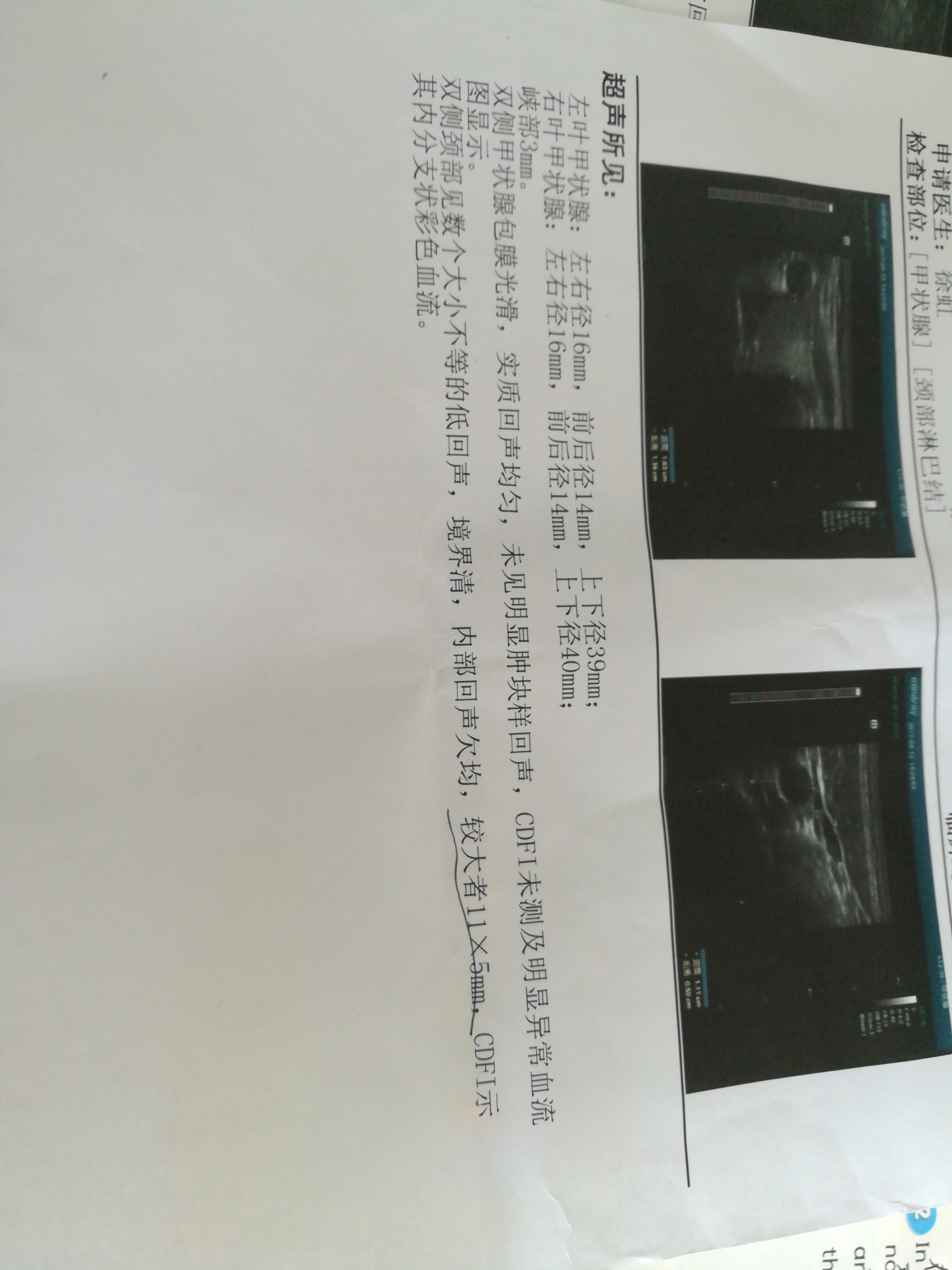 095222tbkil8fwifb4ypci.jpg