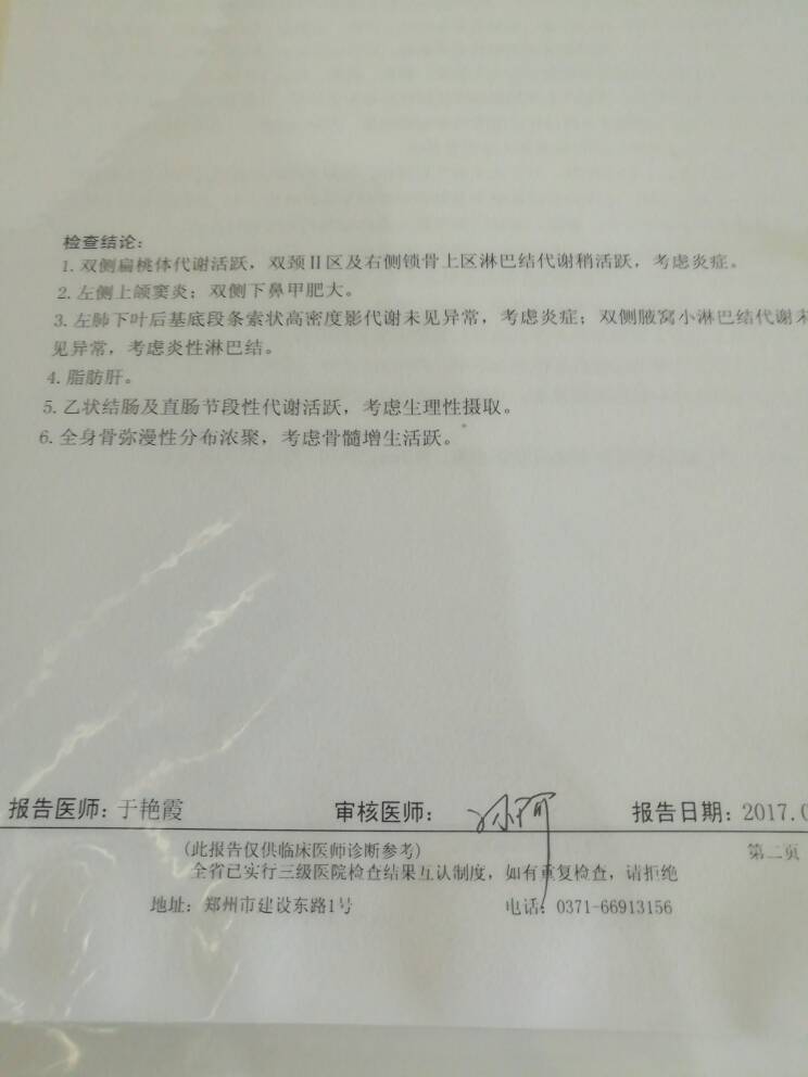 115512gmtzmsegkosm3m2x.jpg