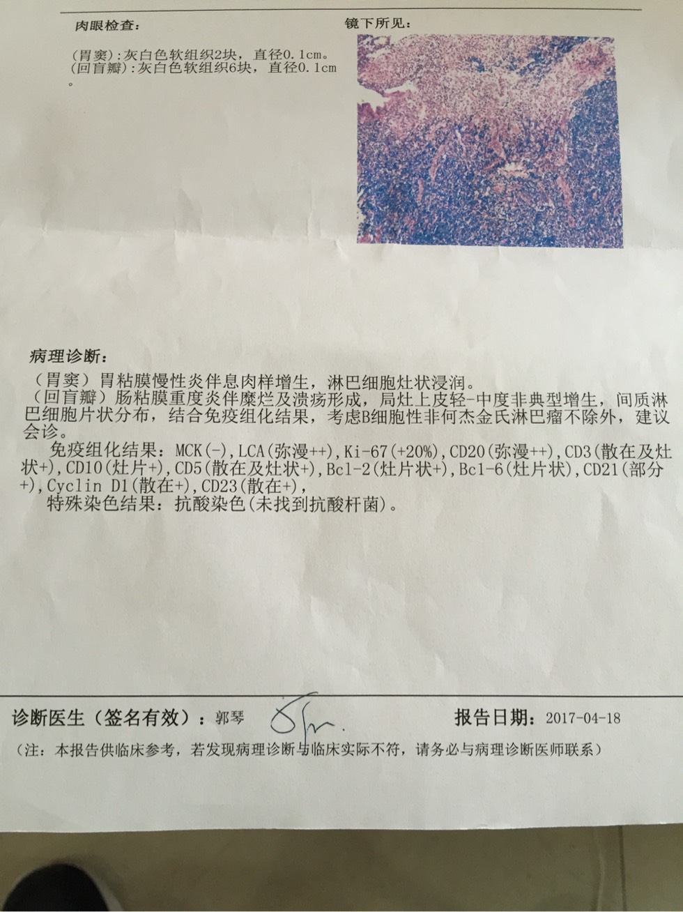 115113nk6k6s3ja8ezmksv.jpg