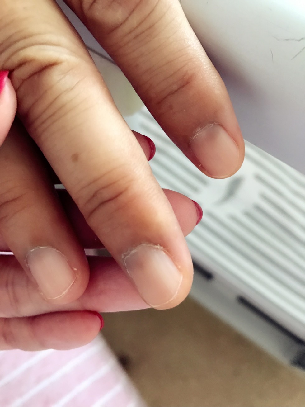 指甲小月亮发黑有什么好办法么